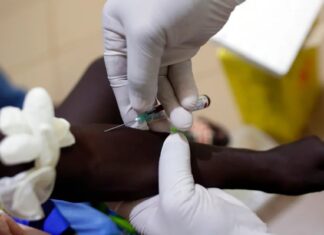 США встановлюють пріоритети для розповсюдження ліків від ВІЛ, виключаючи Південну Африку з політичного маневрування